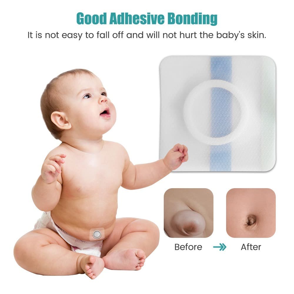 20PCS Pacote Umbilical Convexo Infantil Da Hérnia Do Umbigo Remendo Descartável Bebê Respirável