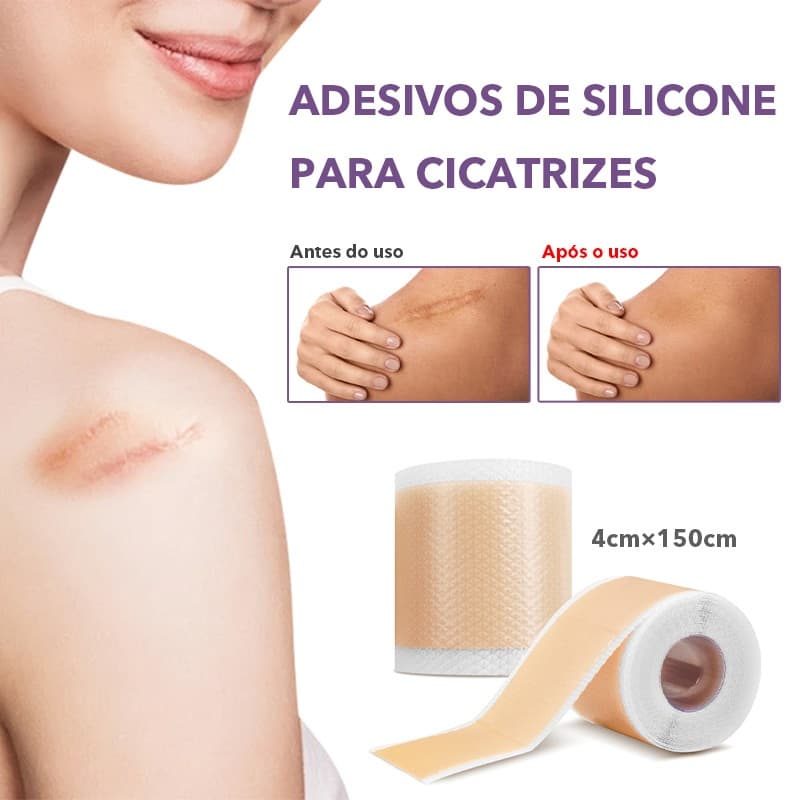 Fita De Silicone Para Cicatrizes Queloide Pós Operatória Cesárea Grau Médico Reutilizável Hipoalergênico