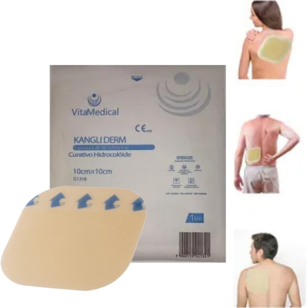 Kit 2 Hidrocoloide Sacral Para Tratar Úlceras Corpo 10x10cm