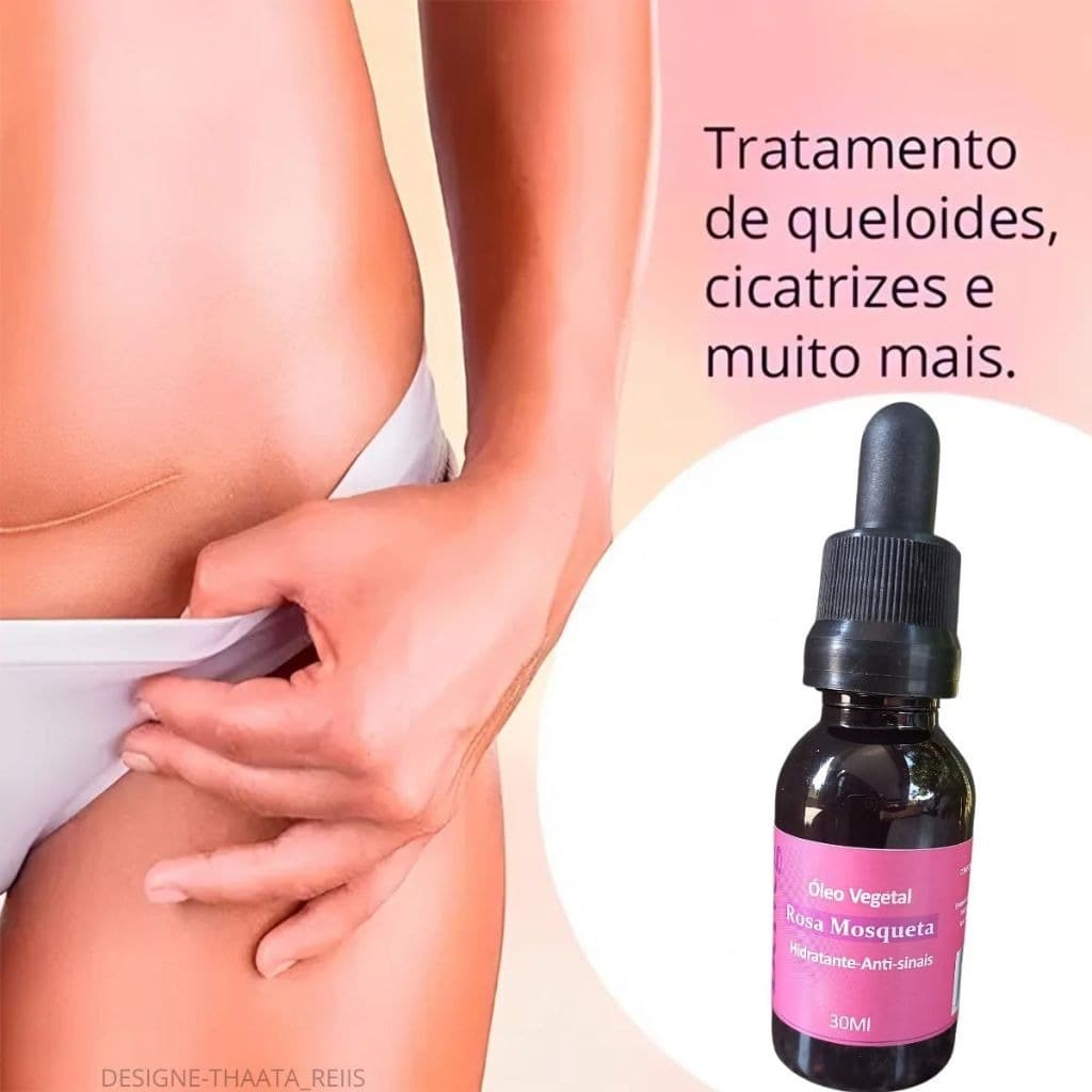 Óleo Vegetal De Rosa Mosqueta 100% Natural 30ml Hidrata Clareia Antissinais 75/120  * Categoria Beleza >