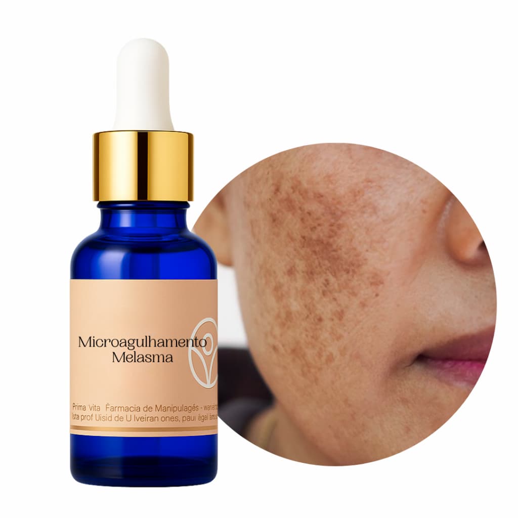 Sérum Microagulhamento para Melasma 30ml Clareador Profissional