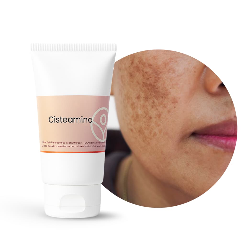 Tratamento Clareador Melasma Cisteamina 30g Facial Prima Vita