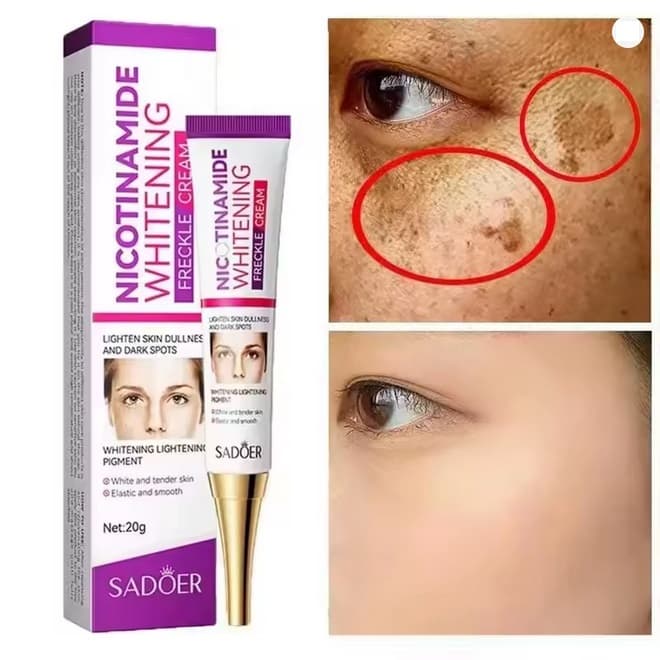 Creme Clareador Anti-Sardas Removedor de Manchas Escuras 20g - SADOER