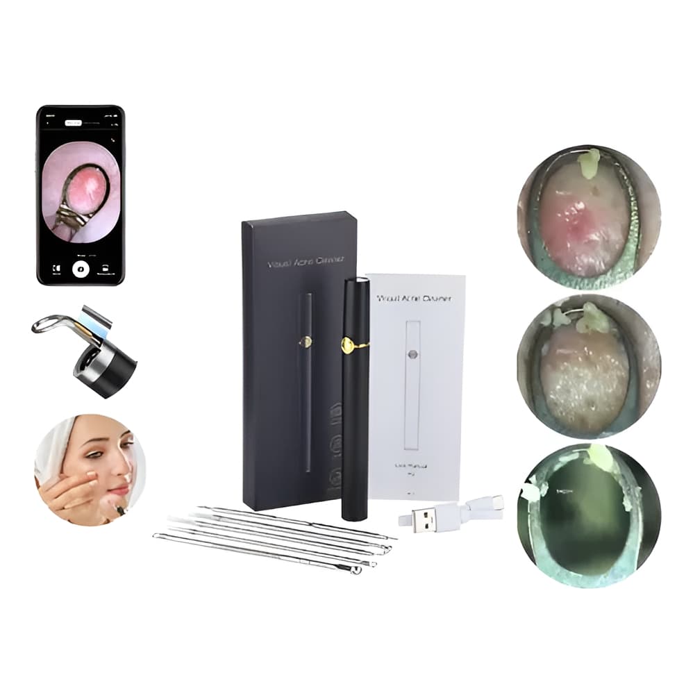 Aparelho Removedor de Cravos com Câmera HD para Limpeza Facial