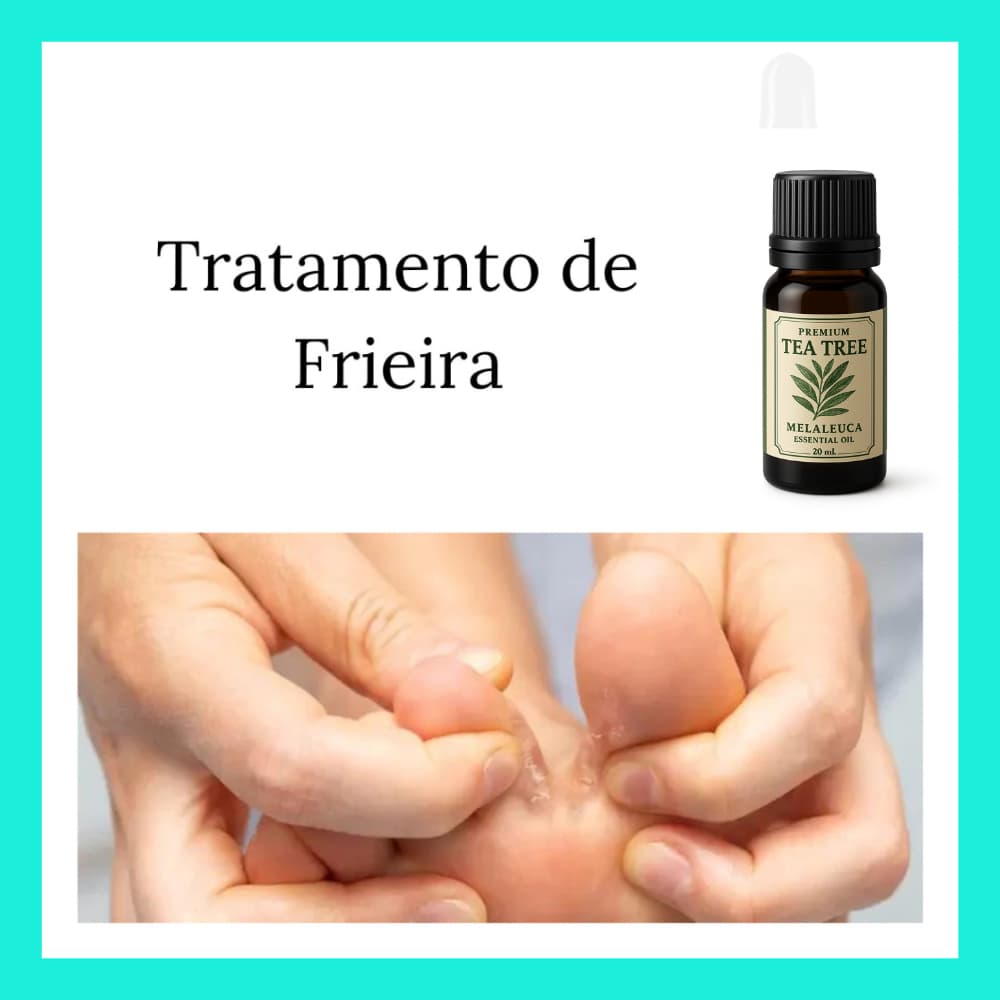 Óleo de Melaleuca Tea Tree 20ml 100% Puro Natural