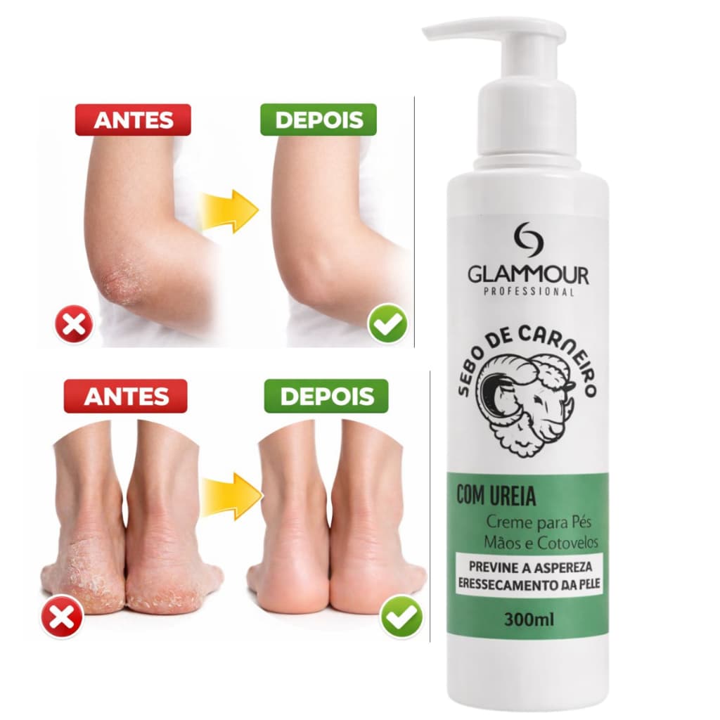 Creme para Pés Mãos e Cotovelos Sebo de Carneiro com Ureia 300ml