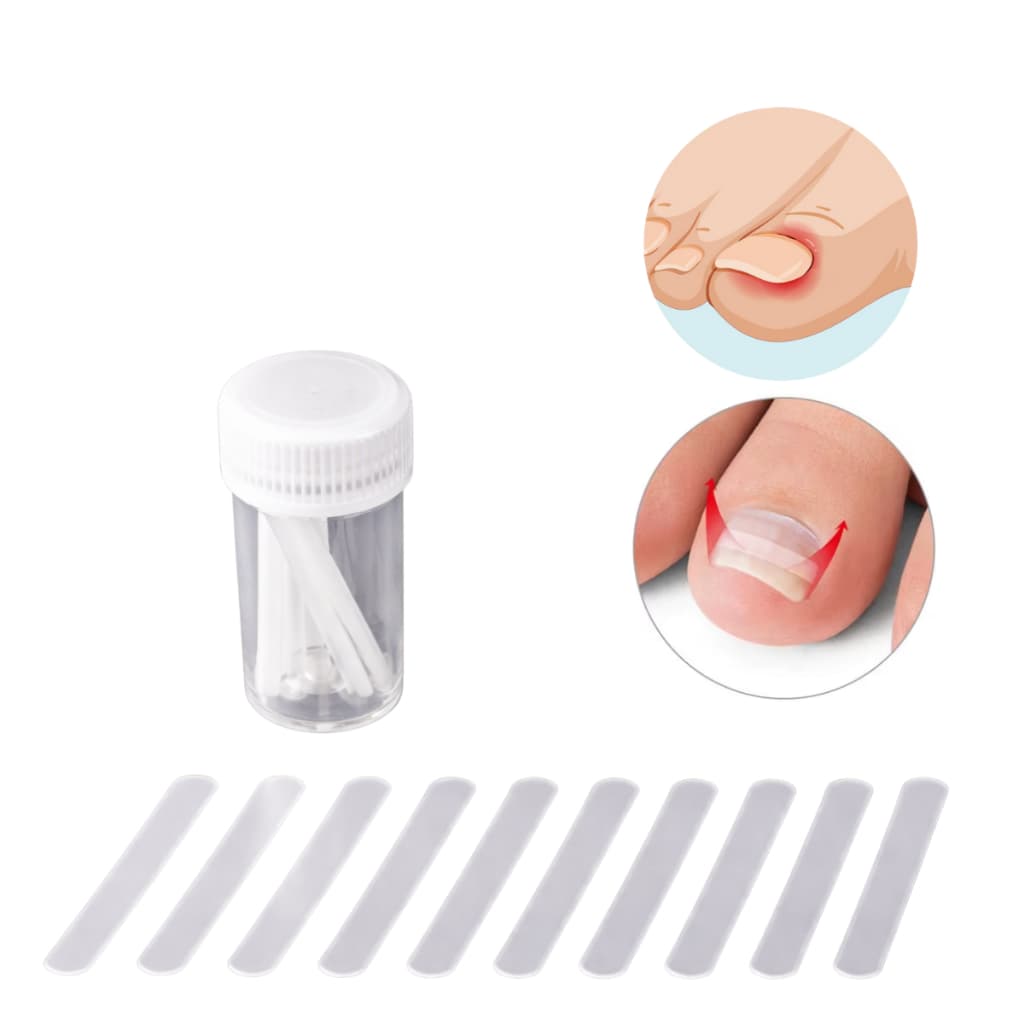 Kit Fitas Corretora de Unha Encravada Paroníquia Cuidados com os Pés Pedicure Podologia