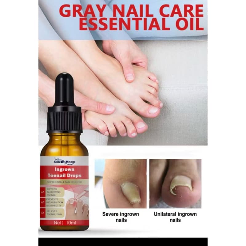 1 tratamento  para micoses nas unhas e fungos unhas podres branca