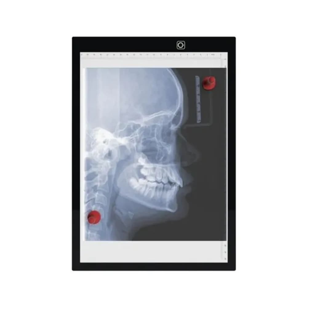 Negatoscópio com imã Grande A3 ou A4 Chapa Radiografia Portátil
