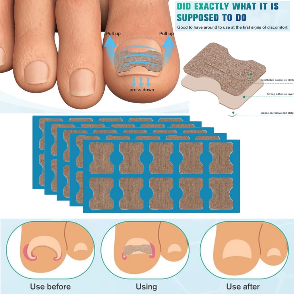 Kit 20/10/5 Adesivos Órtose Correção de Unhas Encravadas Manicure Pedicure Adesivo Unha