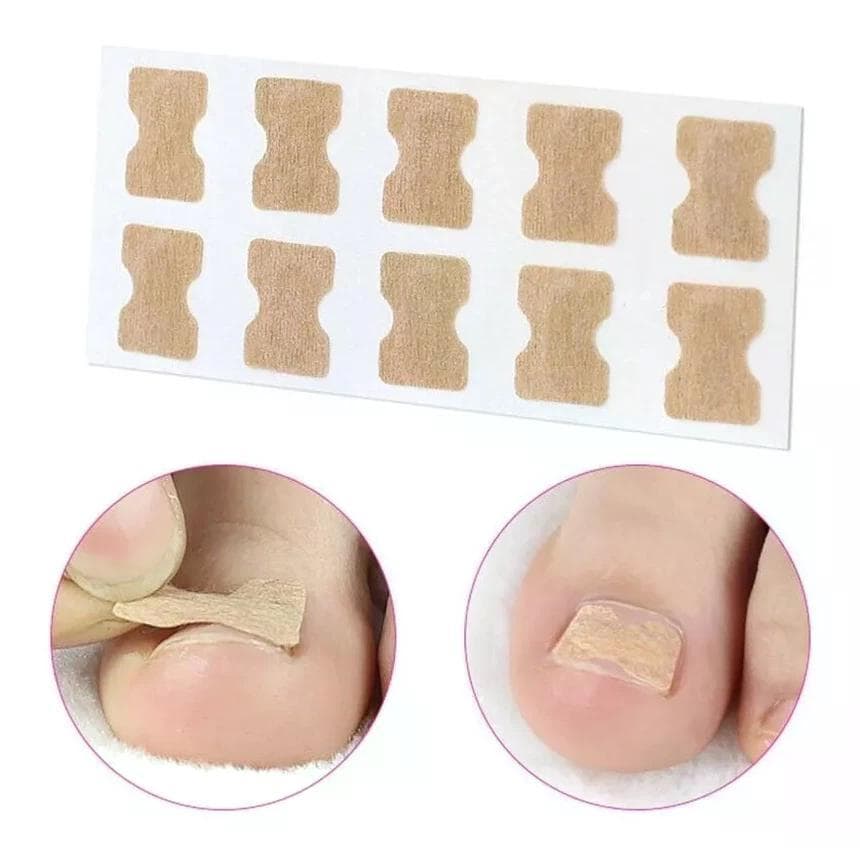 Kit 20 Adesivos Órtese Correção de Unhas