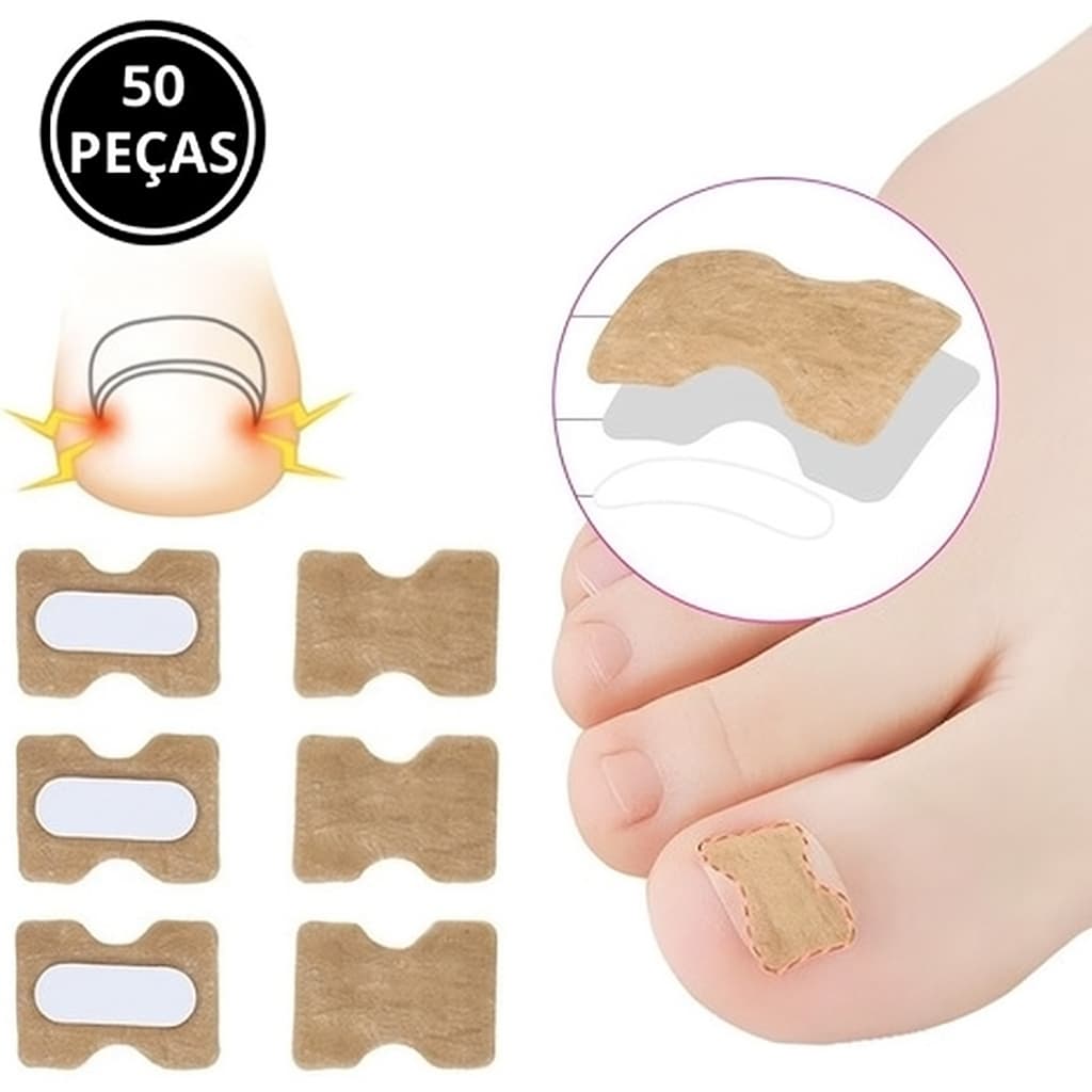 Kit 50 Adesivos Órtese Correção de Unhas