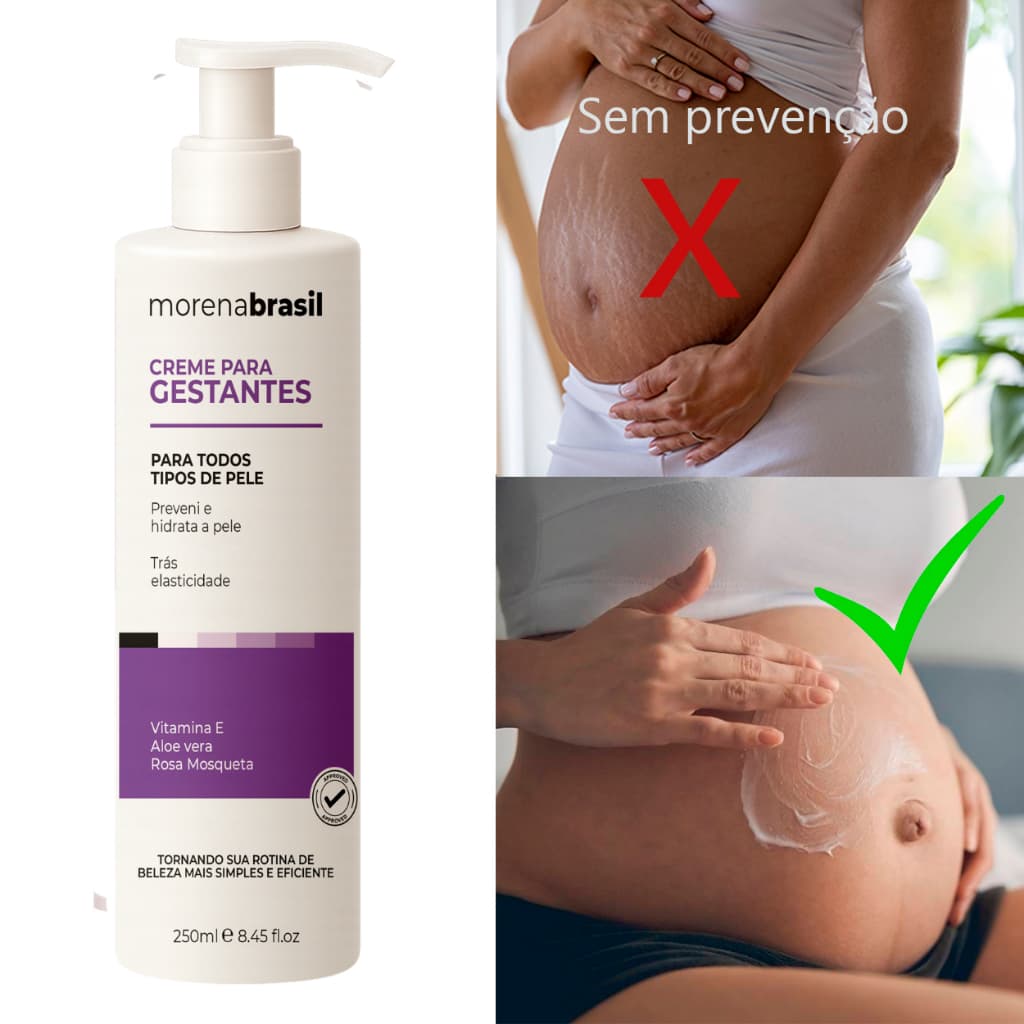Creme Prevenção de Estrias 🤰🏽 Segurança e Hidratação para Mamães!