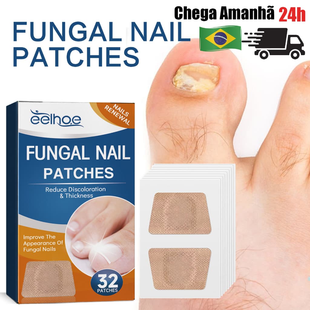 Adesivo Reparador para Unhas Grossas e Amareladas dos Pés Aparência Irregular por Fungos