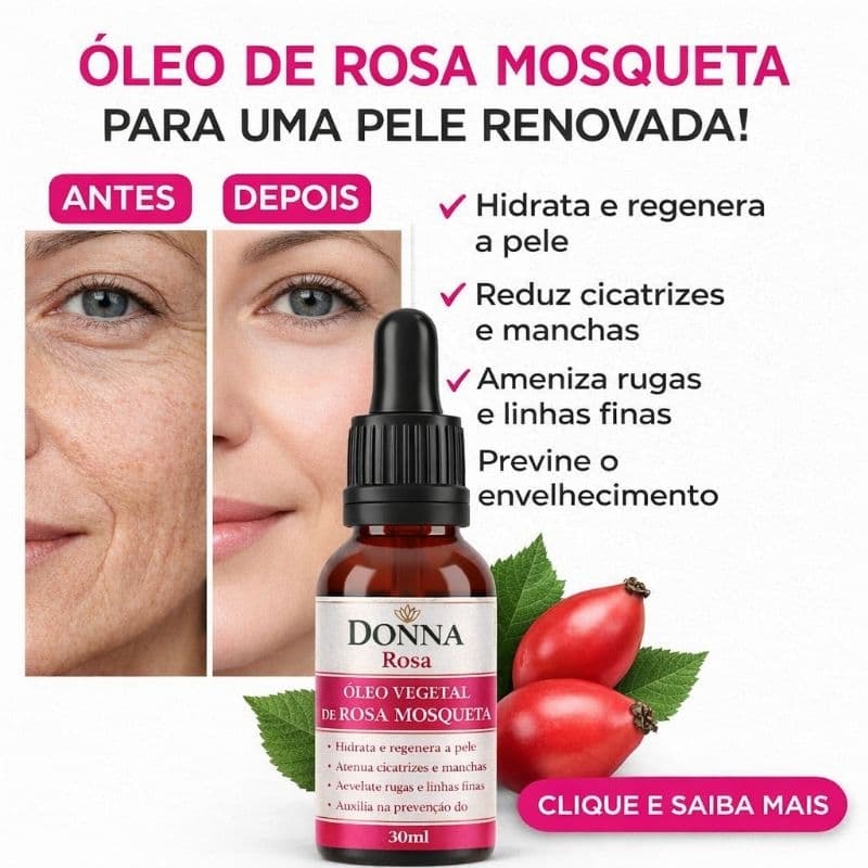 Óleo ROSA MOSQUETA RUBIGINOSA 100% NATURAL Clareador Natural de pele Donna Rosa 30mL