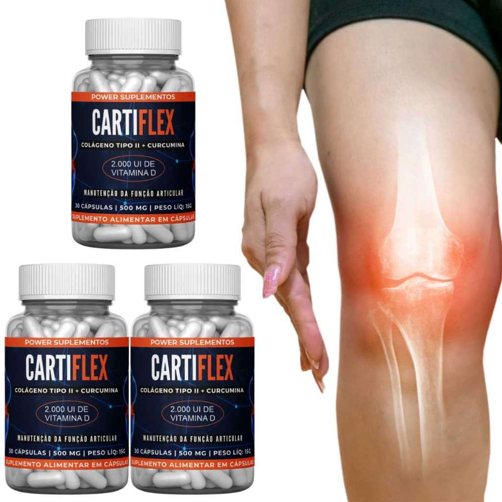 Cartiflex Colágeno Tipo 2 + Curcumina + Vitamina D Ultra Concentrado Suplemento Suporte Articular