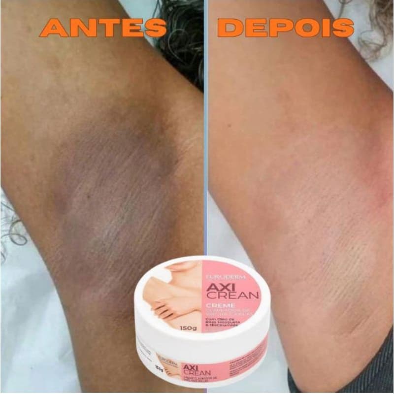 Kit  Clareador de Virilha e Axila Axiclean 150g