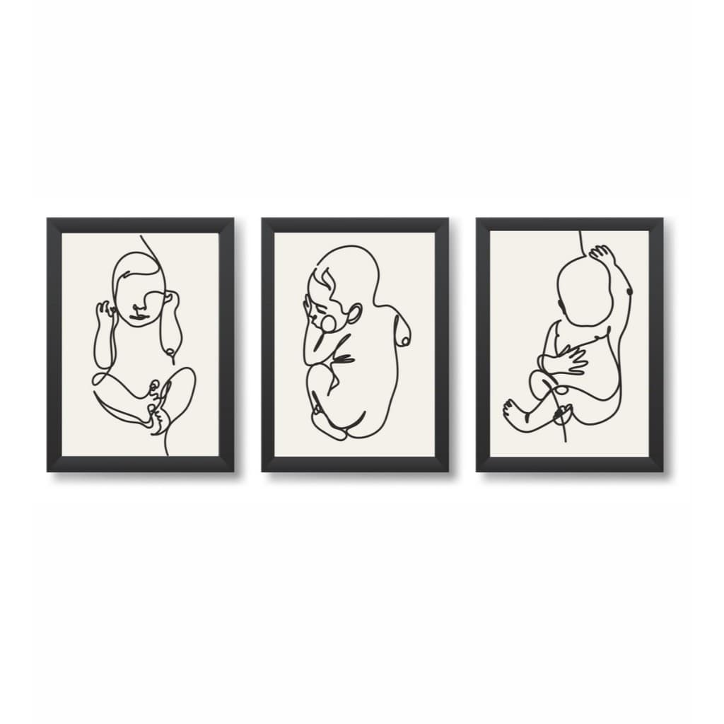 Quadros Decorativos Bebè Gestação Obstetrícia