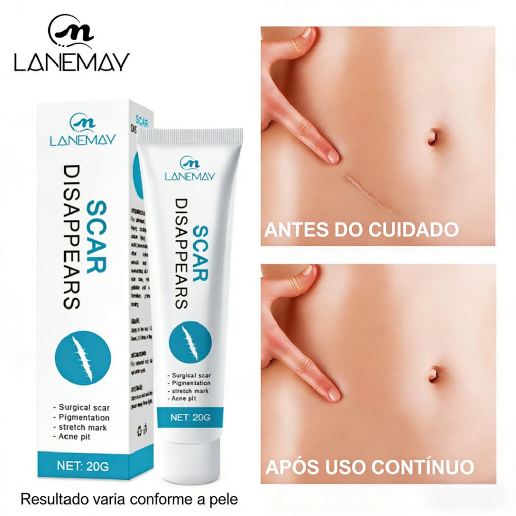 Creme para Cuidado Intensivo da Pele 20g – Uso Diário para Aparência Mais Uniforme