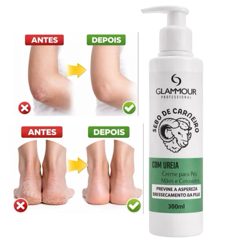 Sebo de Carneiro com Ureia 300 ml Massageador Glammour Alívio de Dores Musculares e Articulares