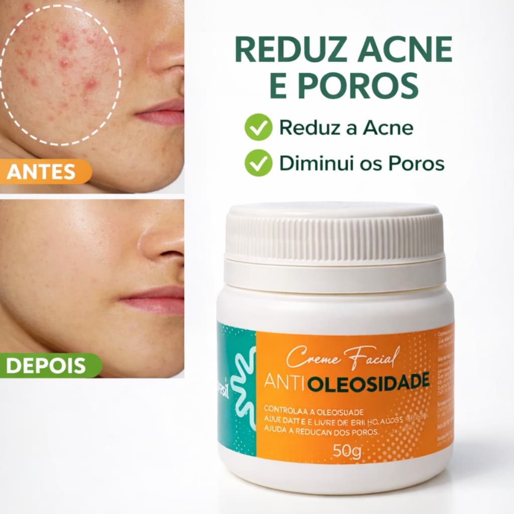 Creme Anti Oleosidade e Acne Facial Hidratante 50g