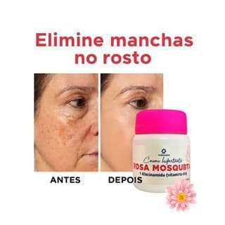 Creme Clareador Rosa Mosqueta com Niacinamida | Manchas no Rosto Antirrugas 50g