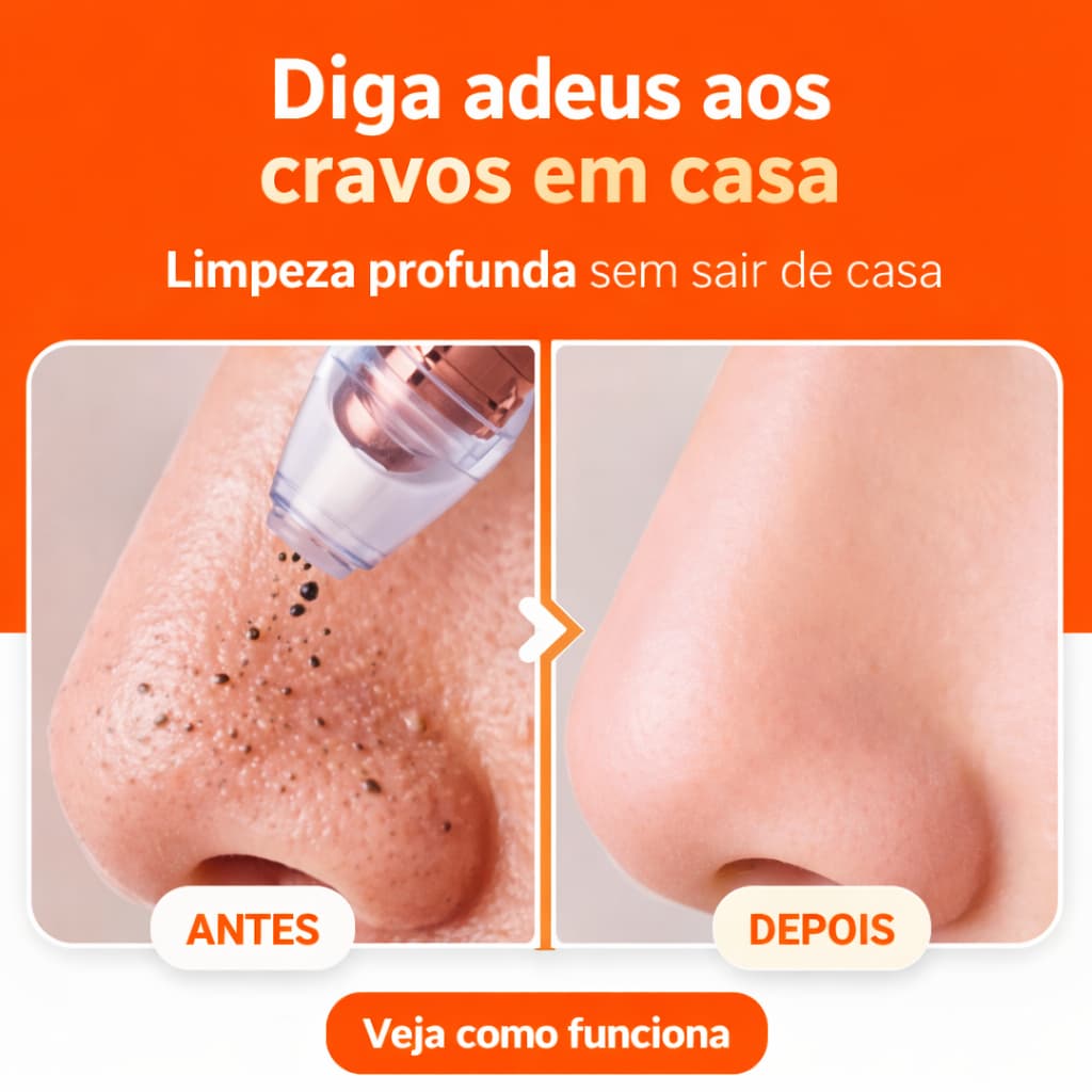 Aparelho Removedor de cravos e espinhas Limpeza Facial a Vácuo Recarregável USB com 5  Ponteiras