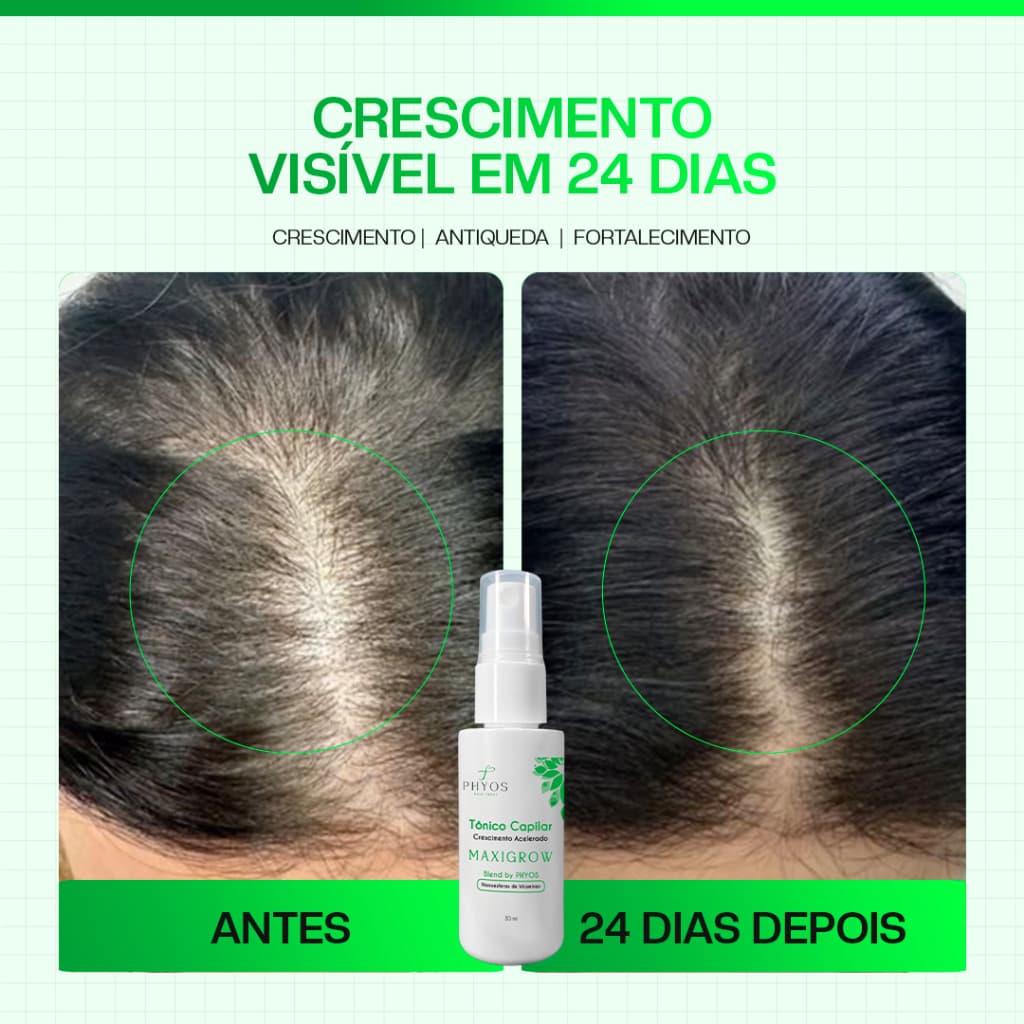 Tônico Capilar Crescimento MaxiGrow Phyos 30ml Anti Queda