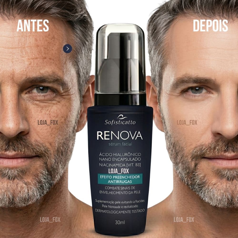 Sérum Facial Renova Ácido Hialurônico 30ml Sofisticatto - Antirrugas Preenchedor  Remove manchas, Rejuvenescimento