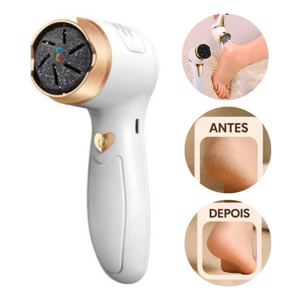 Esfoliador Elétrico Para Pés Portátil Lixa Elétrico Removedor calos USB Removedor De Calos Elétrico