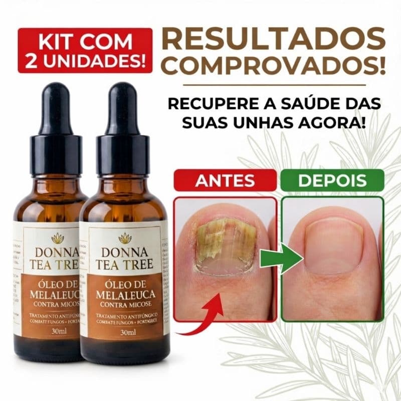 Kit Óleo de Melaleuca Tea Tree Contra Micose e Acne – 2x30ml Antifúngico Natural para Unhas e Pele