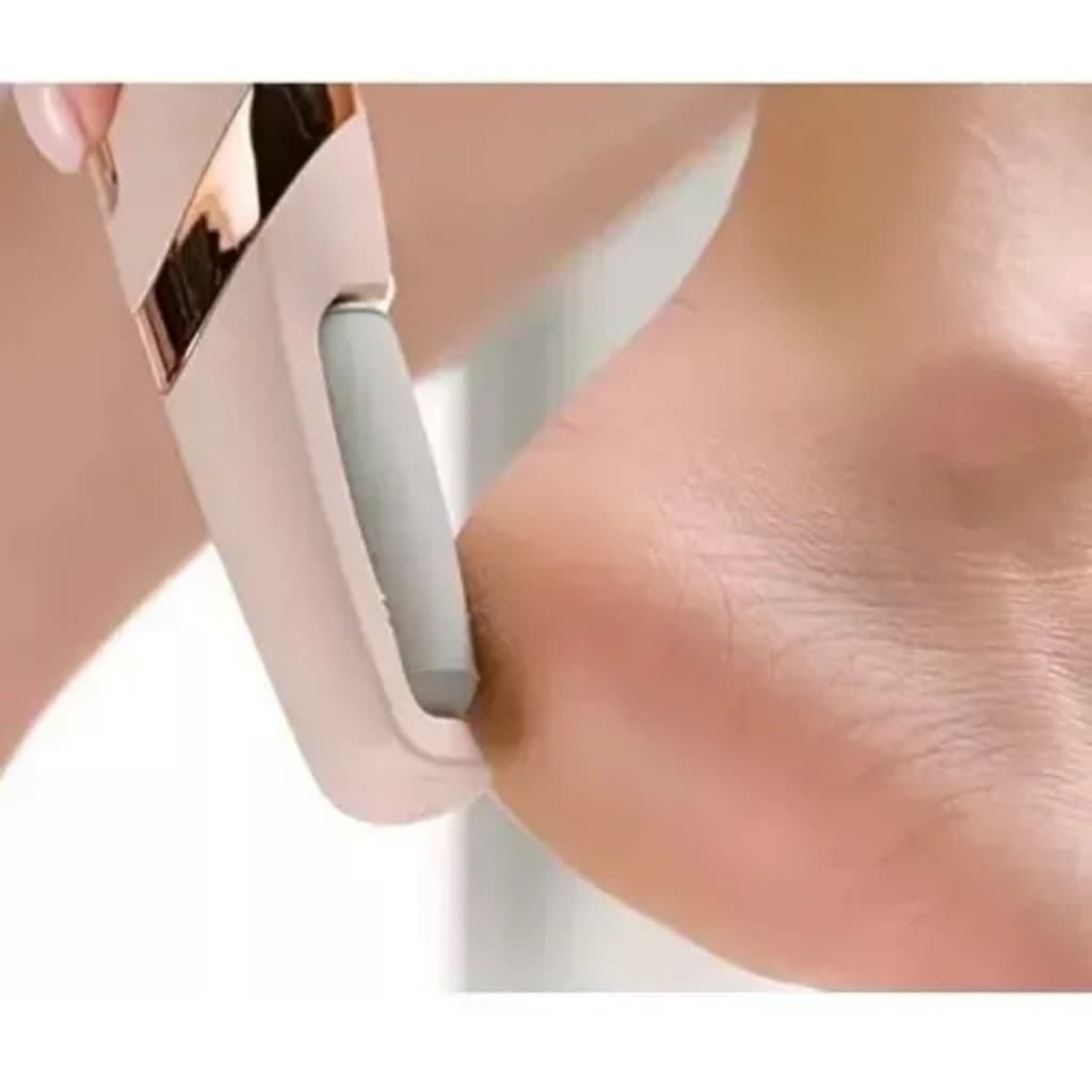 Aparelho Lixa Pés Elétrico Esfoliante Removedor De Calos Usb 110v/220v - Pedicure - Cuidados - Beleza feminina