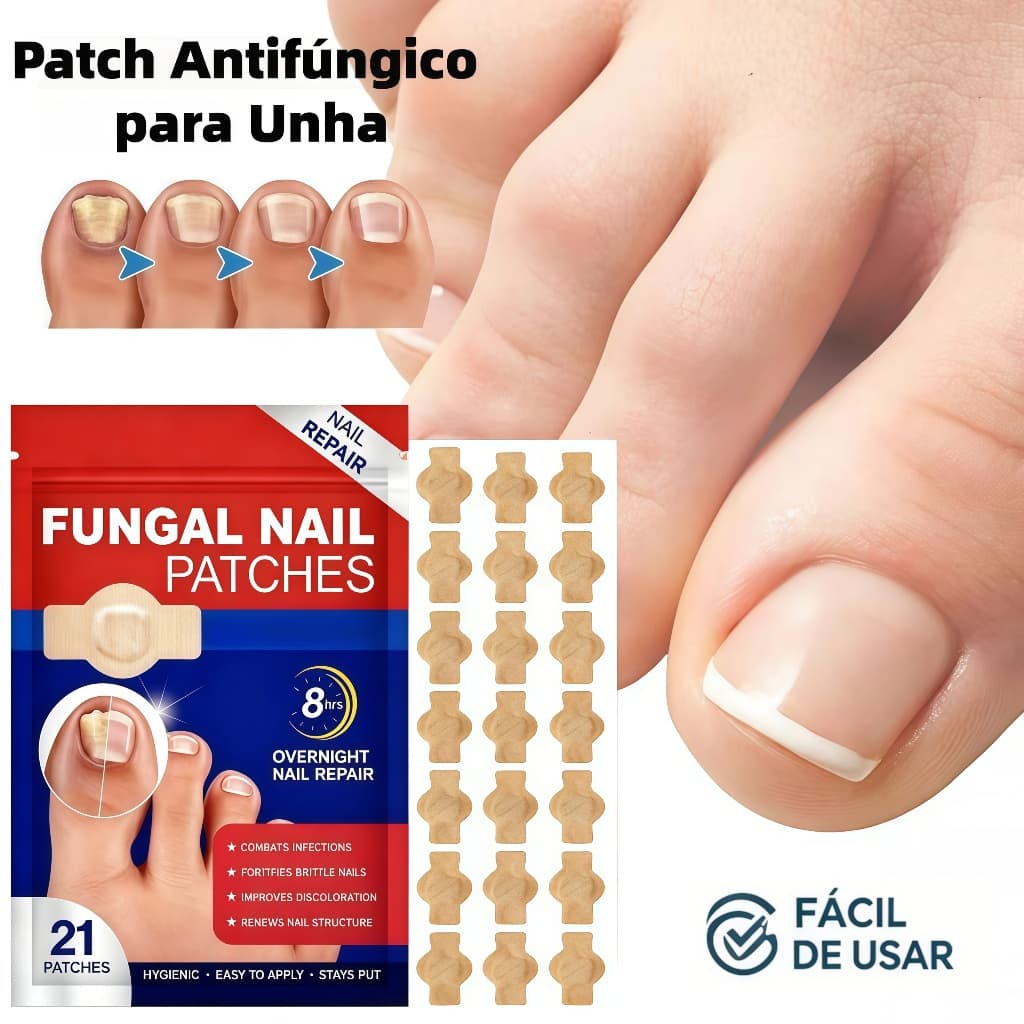 Trate Todos Os Tipos De Fungos Nas Unhas , Absorve Rapidamente E Fácil De Usar