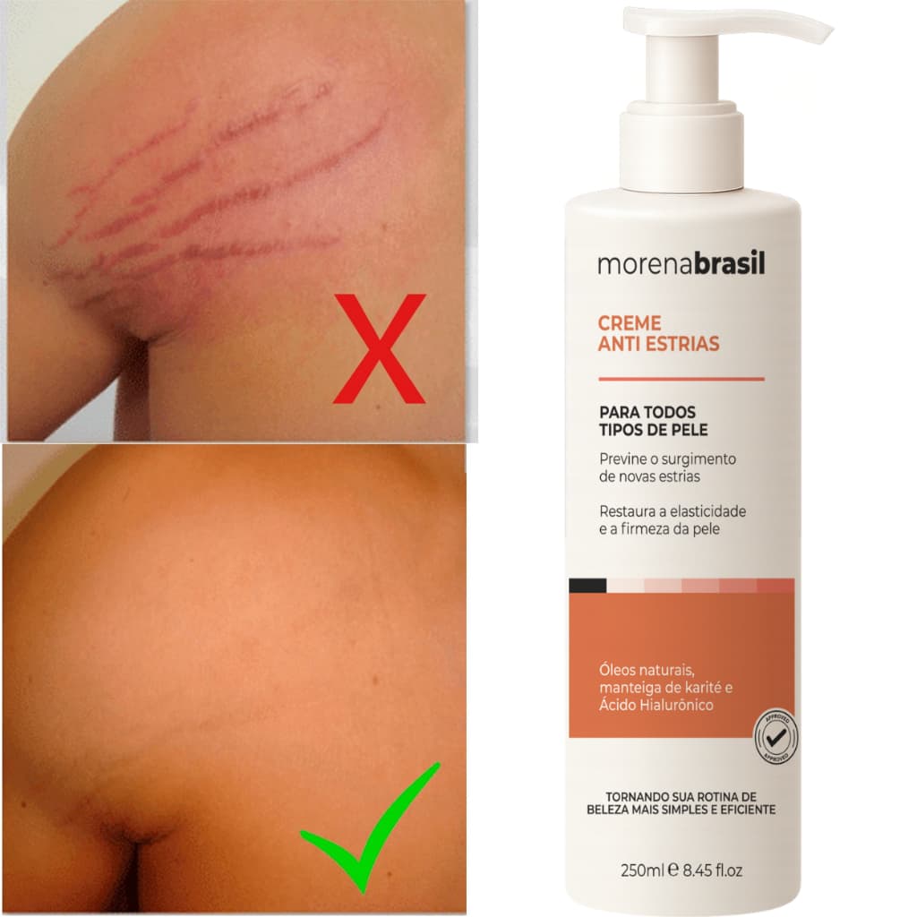 Creme Anti-Estrias Morena Brasil -  Ação Poderosa com Colágeno e Elastina