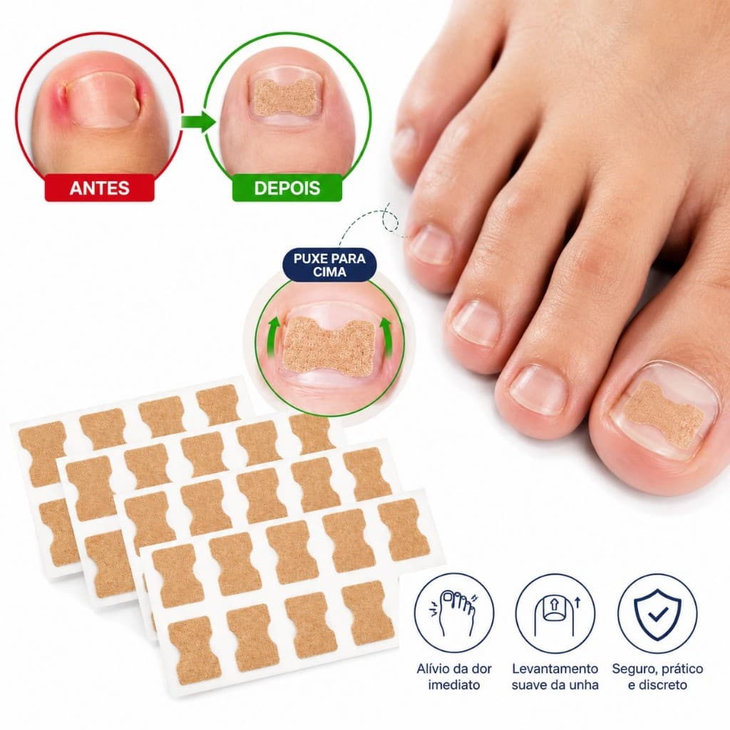30 Adesivos Correção Unhas Encravadas Fitas Desencravador Alívio dor pressão causada unhas