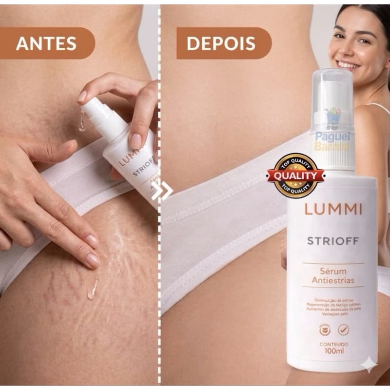 Sérum Antiestrias Clareador Estrias Hidratante Corpo Pele Rosa Mosqueta 100ml Cicatriz Firmador
