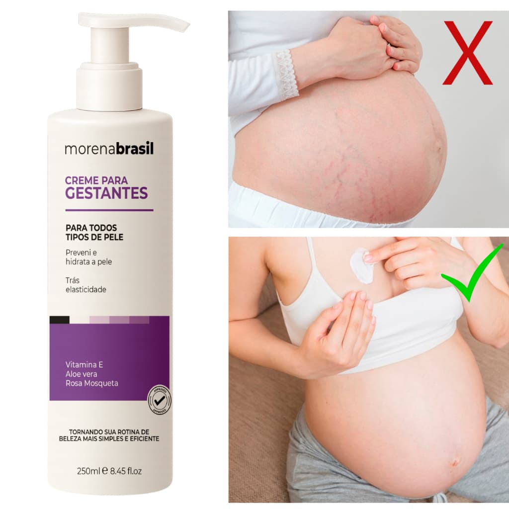 Creme Prevenção de Estrias - Pele Firme e Saudável na Gravidez