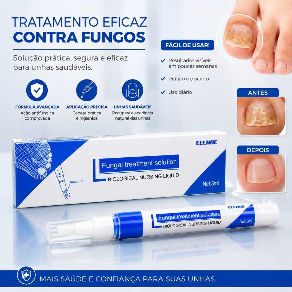 Caneta Unhas Com Solução EELHOE Anti Micose E Anti Fungos Bactérias Tratamento De Micose Na unha