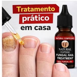 Tratamento para Micose de Unha Antifúngico Óleo Fungicida Remove Fungos Unha Amarelada Forte e Grossa 10ml preta