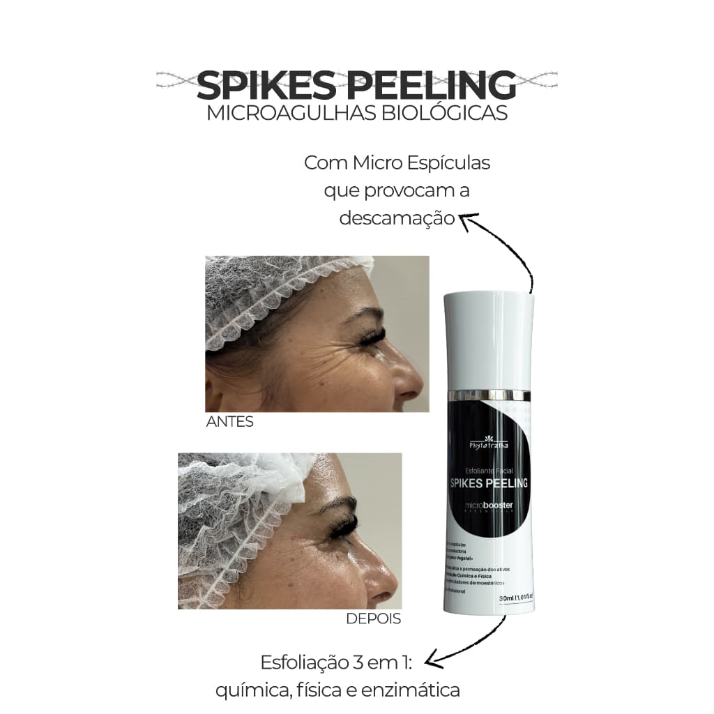 Spikes Peeling - Microagulhas Biológicas Tecnologia Coreana 30g - Microbooster