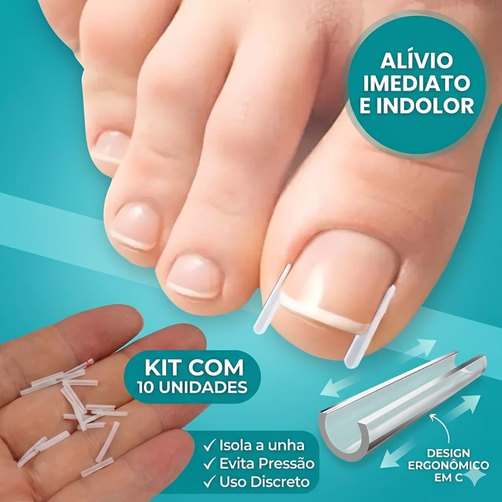 Kit 10 Unid Corretor Unha Encravada Órtese Formato C Tubular Silicone Flexível Alívio Imediato Profissional
