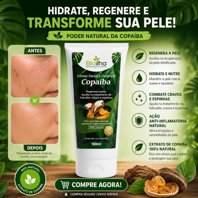 Creme Hidratante de Copaiba 100ml - Auxilia no Tratamento de Cravos e Espinhas