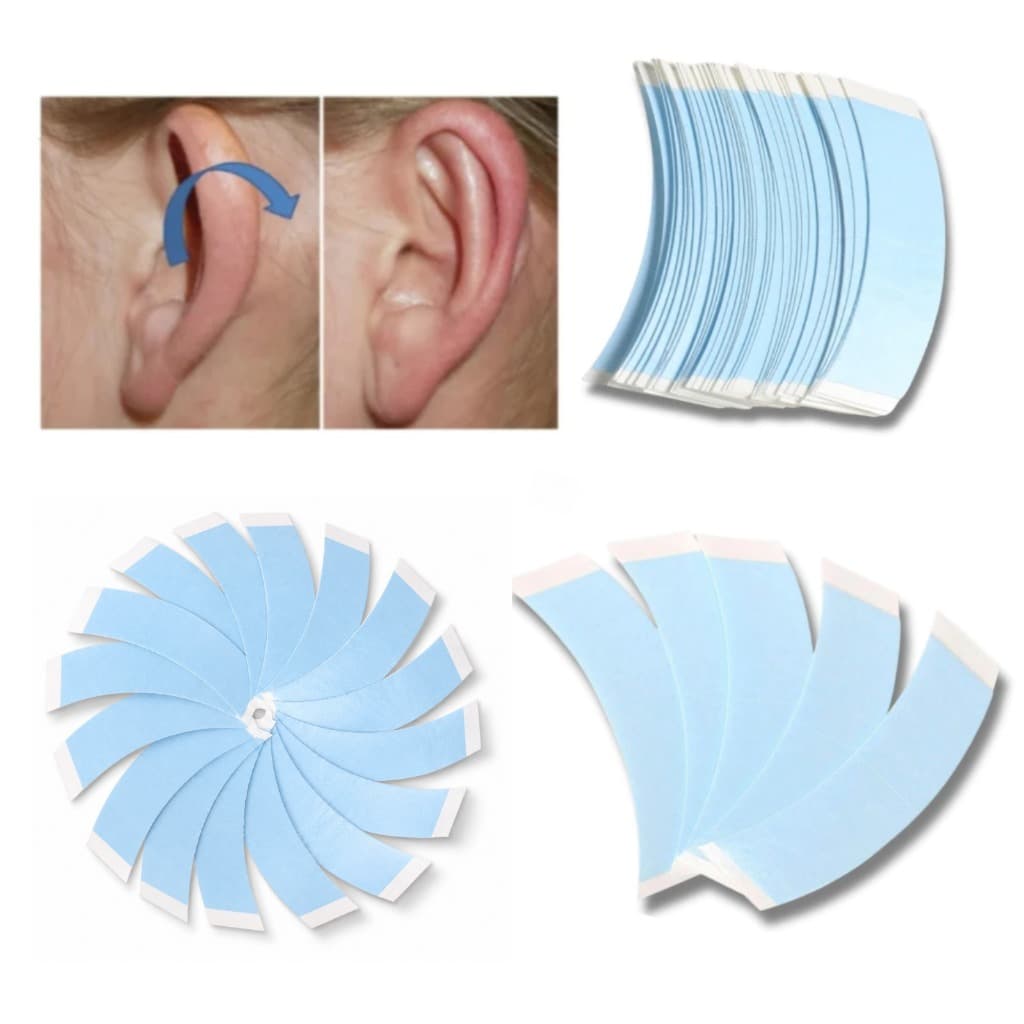 Kit Fita Adesiva Para Correção Orelha De Abano Criança Adulto Bebes 36 Uni Tiras Lace Cola Forte