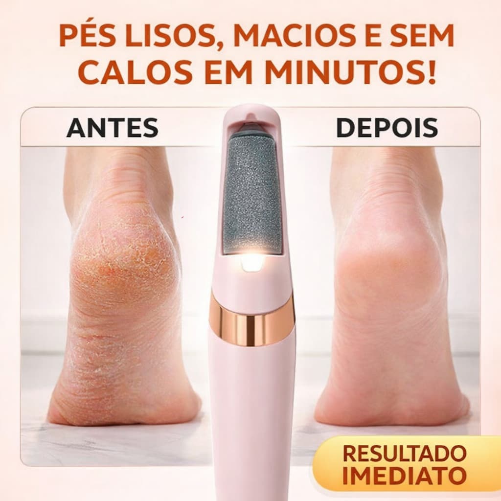 Lixa de Pé Elétrica Recarregável Removedor de Calos à Prova D’Água Pedicure Profissional USB