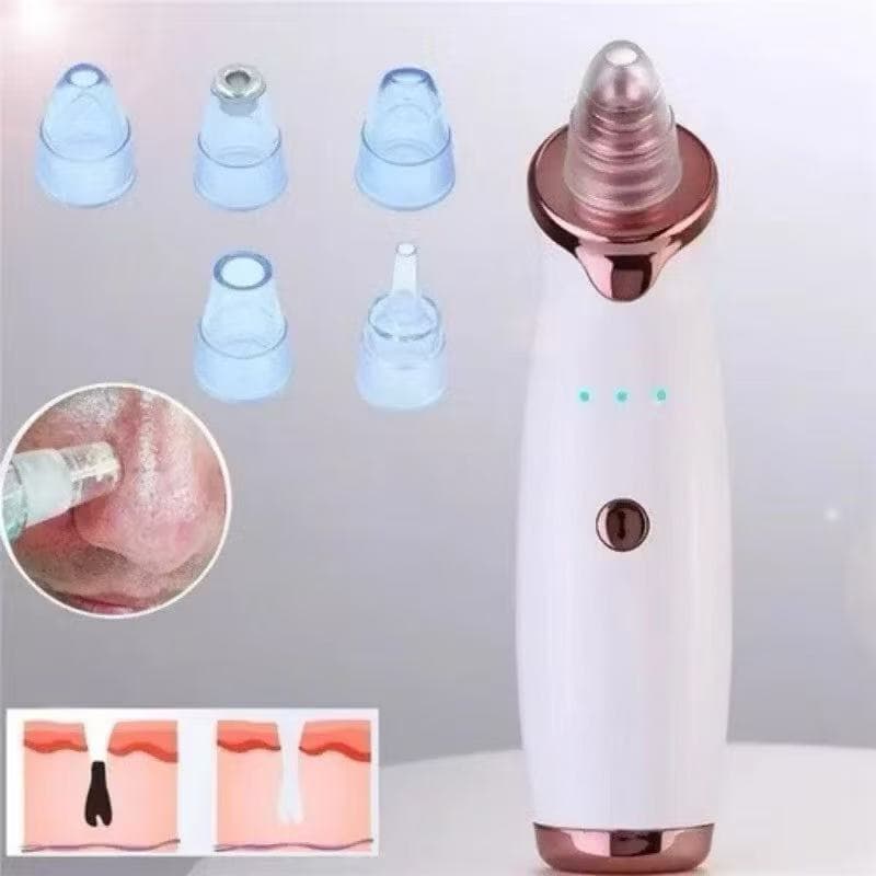 Removedor de Cravos Elétrico a Vácuo – Limpeza Profunda Facial Antiacne e Aspirador de Poros