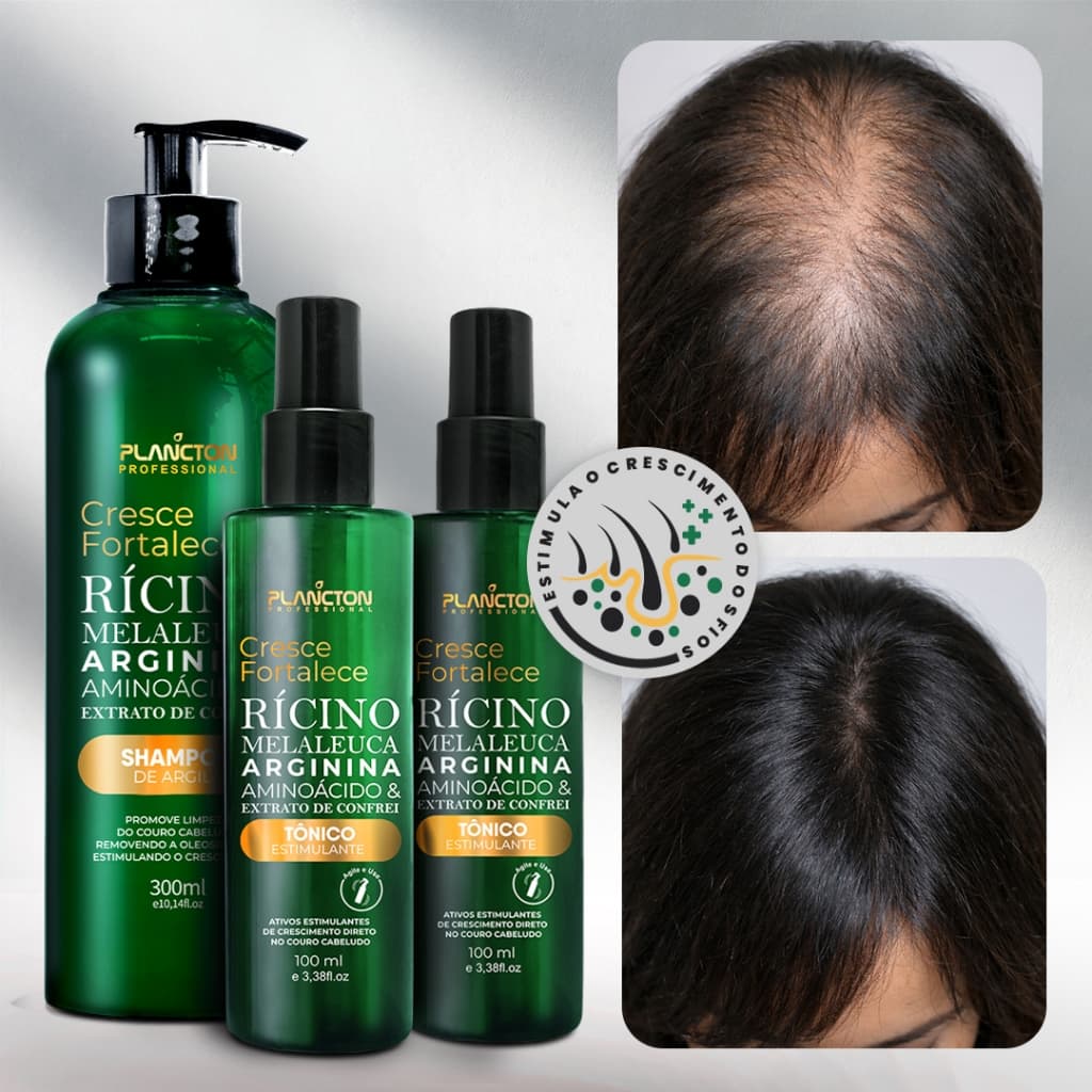 Kit Tratamento Crescimento Plancton Cabelo Barba Sobrancelha Antiqueda 60 Dias