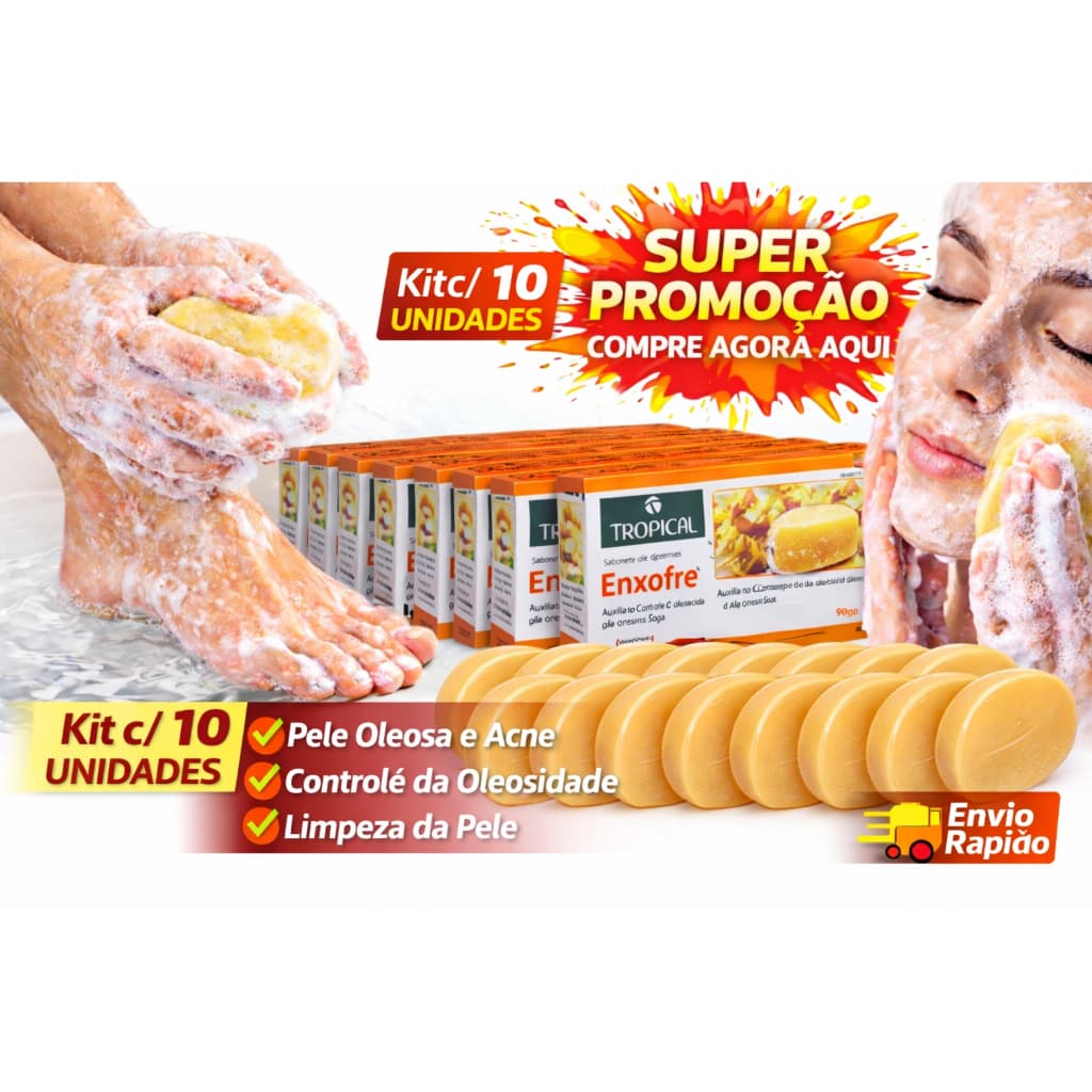 Kit 10 Sabonete Enxofre Tropical Para Acne Oleosidade Limpeza Facial-Compre Já Aqui Sabonete Enxofre