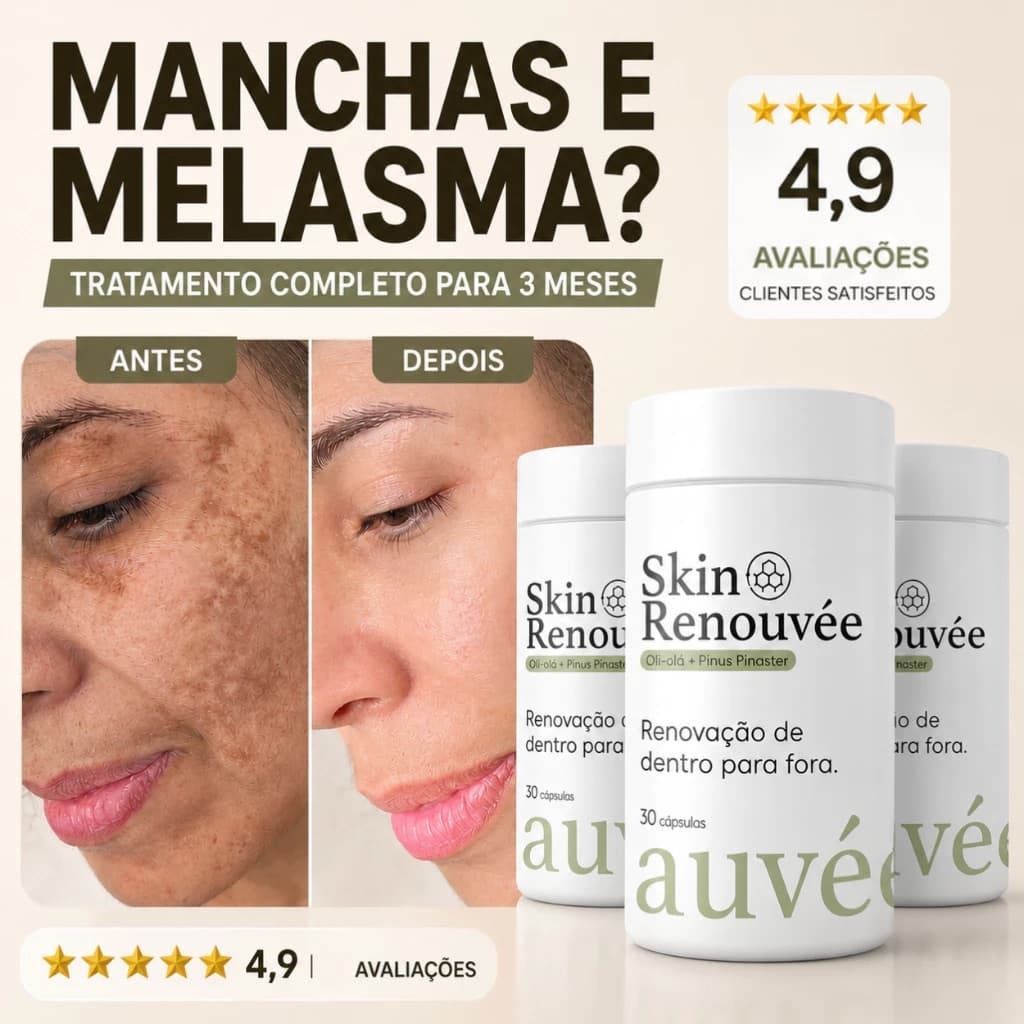 Kit Clareador de Manchas e Melasma Oral - Oli Olá + Pinus Pinaster | 2x 3x ou 5x | Auvée
