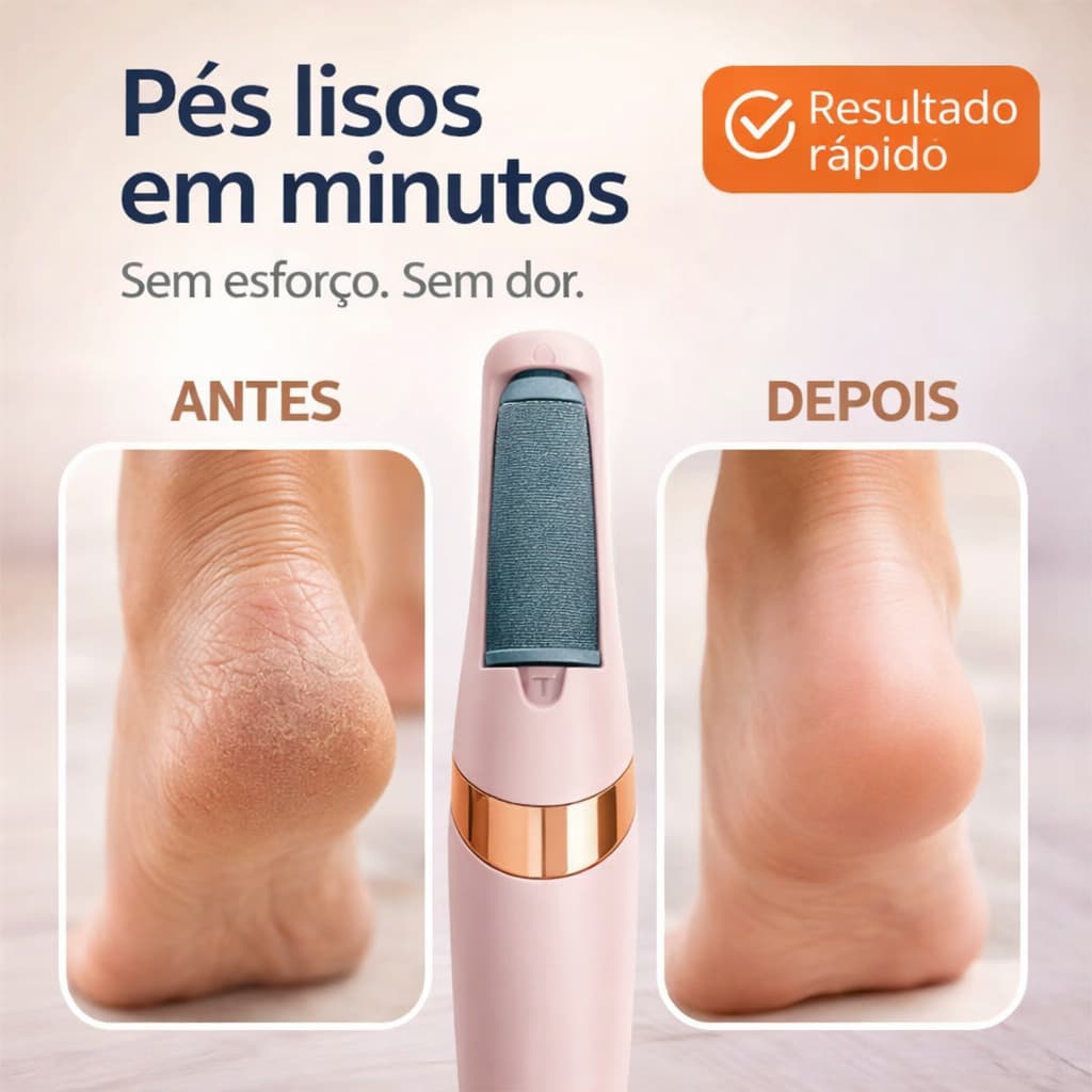 Lixa Elétrica para Pés Recarregável USB Removedor de Calos Profissional Sem Fio À Prova D’água