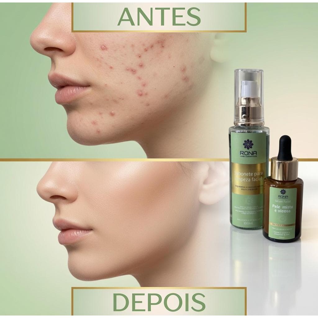 KIT SABONETE E SÉRUM PELE OLEOSA RONA CARE COSMÉTICOS 1118-A